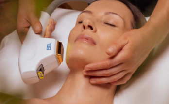 Can I Use Hydroquinone After Broad Band Light Treatment?