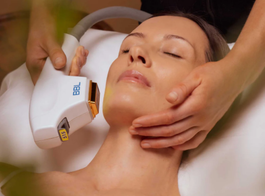 Can I Use Hydroquinone After Broad Band Light Treatment?